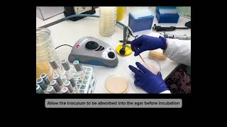 🧀 Enumeration of Staphylococcus aureus | Microbiological Analysis in Cheese Samples