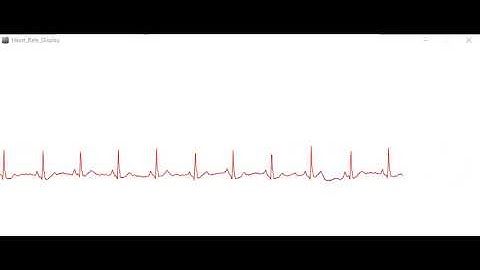 IoT Based Patient  Monitoring System for ICU