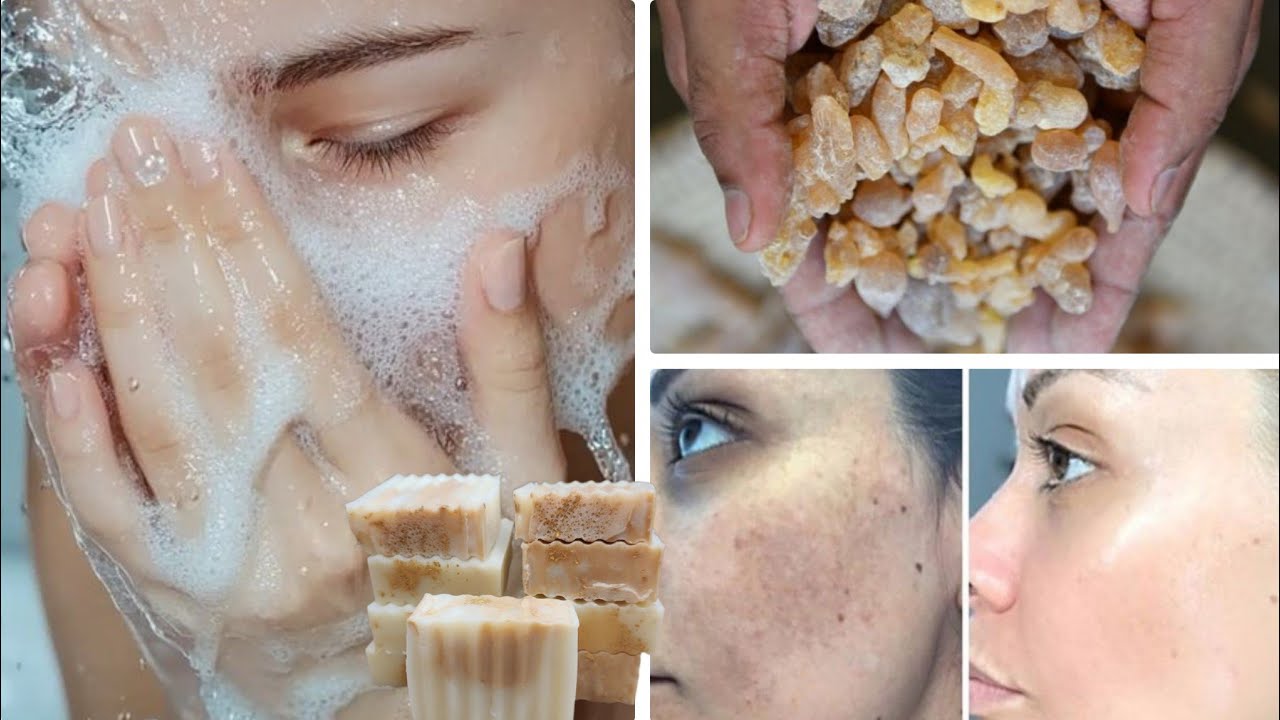 Waa cajib Sabun luwan ama foox wajiga lagu cadeyo skincare soap 