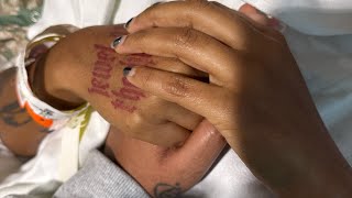 Karla’s Brain Surgery Story | Our Experience With AVM 
