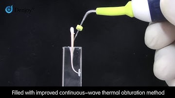 Denjoy iFill GP Obturation System Operation Guidance