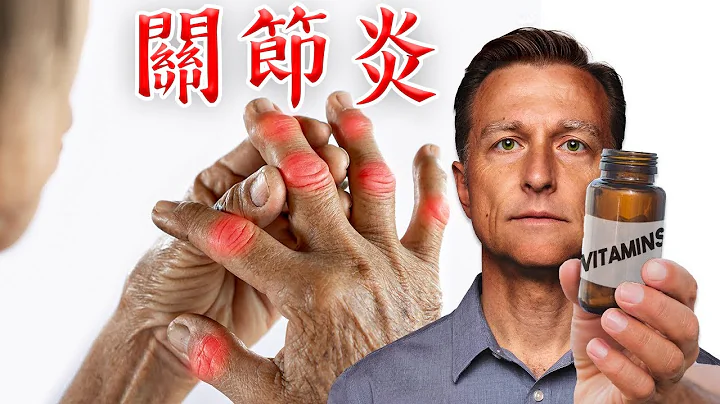 修復關節炎,第一名維生素B3(Niacinamide),自然營養療法,柏格醫生 Dr Berg - 天天要聞