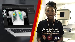 Revolutionizing Healthcare Innovation: THINK's Partnership with USAID and Qure.ai