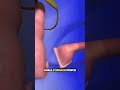 GASTRIC BYPASS SURGERY #nursing #usnurse #nurse #nurselife #nursesrock #nursesday #usnurse