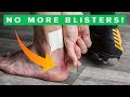 How to never get blisters again | Top 5 blister hacks