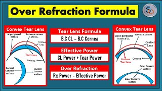 Over Refraction Calculation In Just 3 Simple Steps.