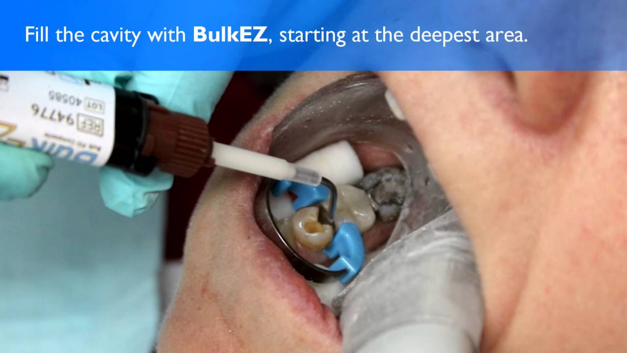 Danville's New Bulk EZ Patient Demonstration YouTube