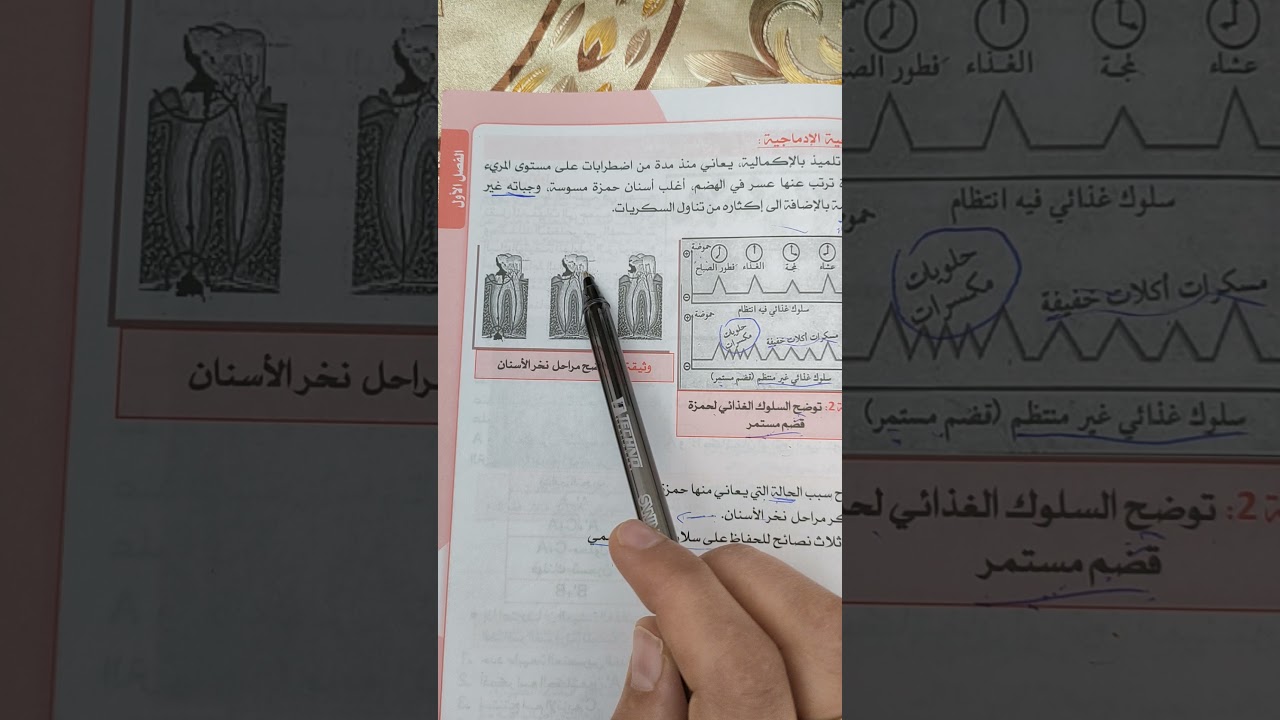 وضعية ادماجية حول تسوس الأسنان