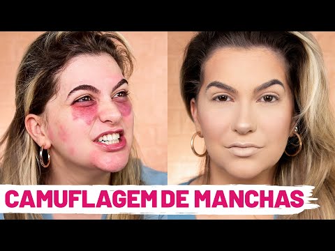 COMO TAPAR MANCHAS NA PELE POR ALICE SALAZAR