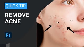 Photoshop 2023 Tutorial: Remove Blemishes and Acne with Ease screenshot 2