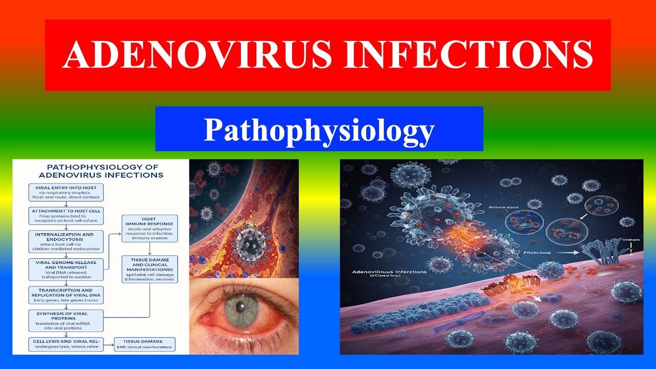 ADENOVIRUS INFECTIONS - Pathophysiology Explained step by step - YouTube