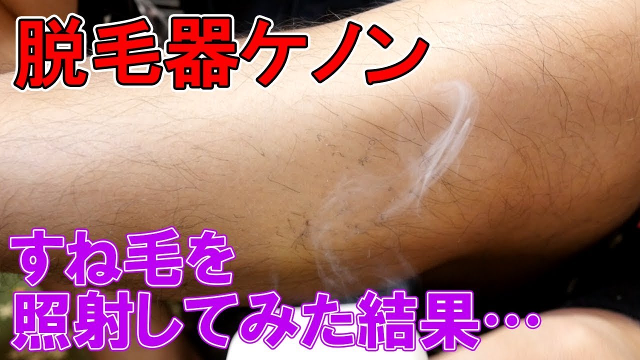 ケノンですね毛を照射 2種のカートリッジでケノンの脱毛力を比較測定