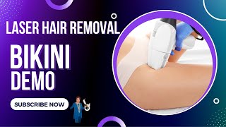 Bikini Laser Hair Removal Demo - What You Should Know!