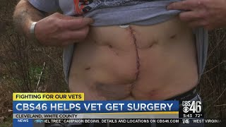 CBS46 helps veteran get abdomen surgery