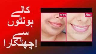 کالے ہونٹوں سے چھٹکارا screenshot 4