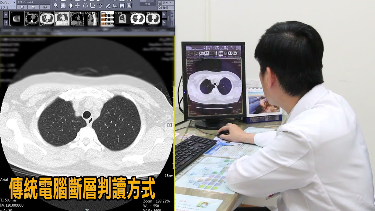 Ai 電腦 斷層 掃描 中心 (99) 사진