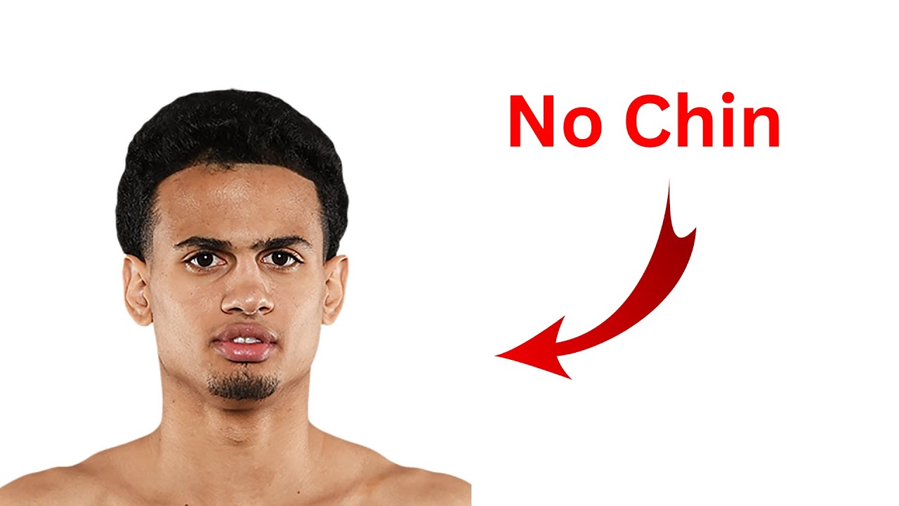 Fighters who have LOST their Chin... YouTube