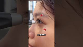 Cómo miden la presión del ojo en segundos 😧