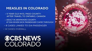 Colorado confirms 14 measles cases in the state