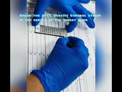 MALDI-TOF mass spectrometry system: VITEK® MS PRIME #shorts#microbiology