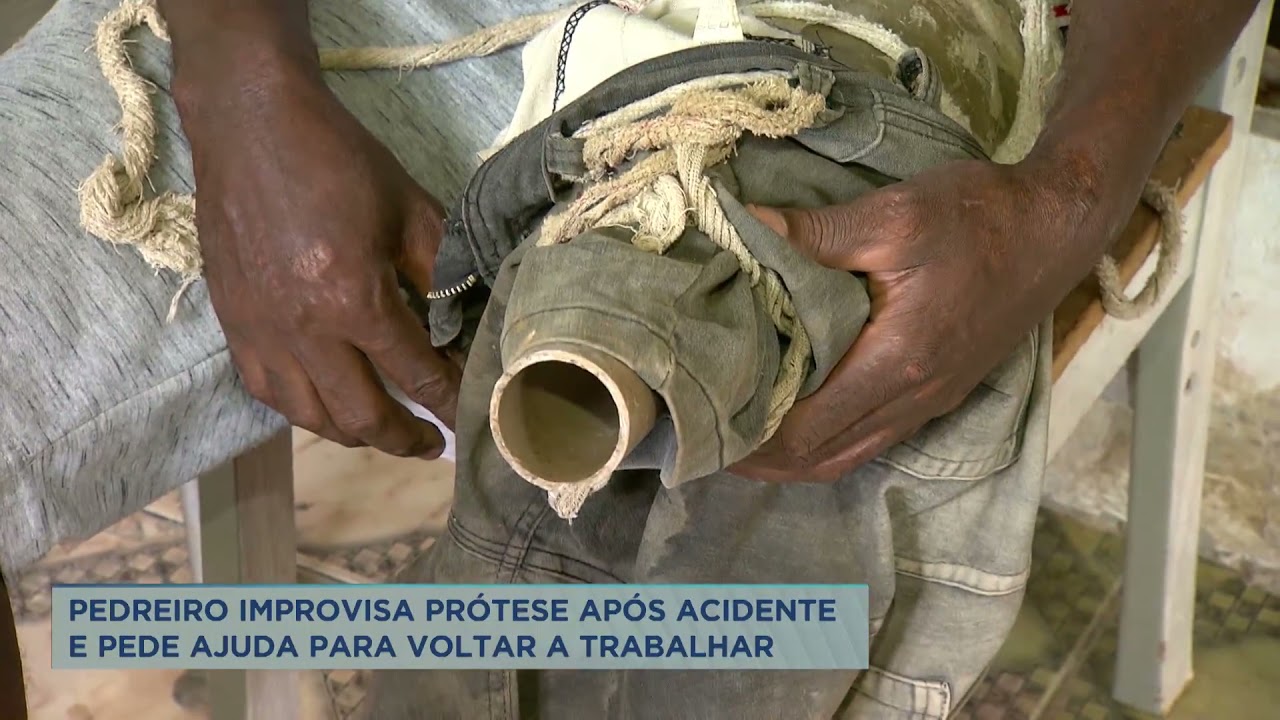 Pedreiro que perdeu uma perna em acidente improvisa uma prótese com PVC