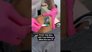PCOS chin wax 💜#waxingvideos #waxing #pcos