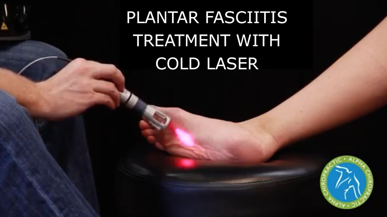 Plantar Fasciitis Treatment With Cold Laser YouTube