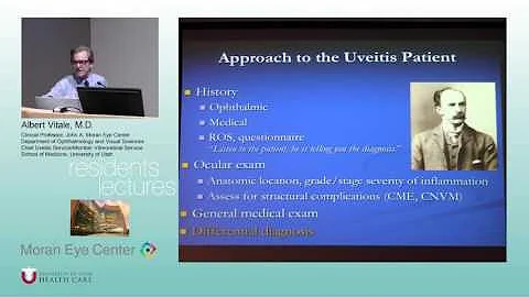 General Principles, Epidemtiology, Classification, Diagnostics Approach, and Treatment of Uveitis