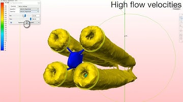 Towards CFD with FPV racing drones