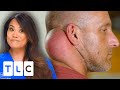 Dr. Lee Removes This Patient’s Second Head Growing On His Neck! | Dr. Pimple Popper