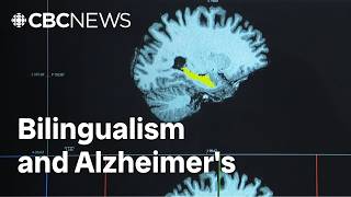 There's no cure for Alzheimer's. But could speaking 2 languages help?