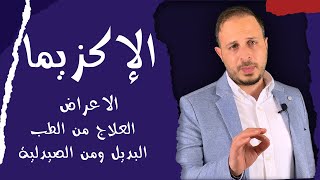 علاج الاكزيما بالادوية وبالطب البديل لنتائج رائعة