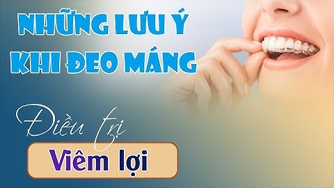 Những Lưu Ý Khi Đeo Khay Điều Trị Viêm Lợi | Bác sĩ Thu Gia Lâm