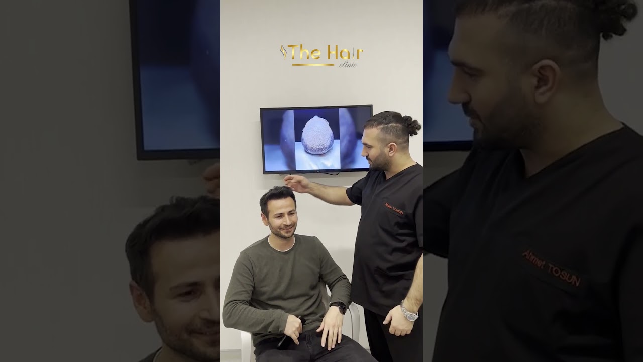 Emrah Bey'in Saç Ekimi Sonrası 14. Ayı. ✨🤗 Ahmet Tosun - The Hair Clinic