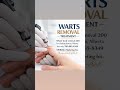 Warts problem? Contact meText only 780-885-8349
