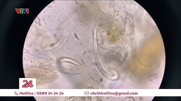 Nữ bệnh nhân tưởng mắc ung thư gan, đi khám mới biết gặp phải ký sinh trùng | VTV24