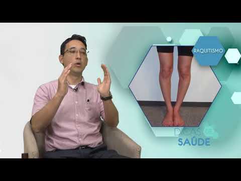 RAQUITISMO | Dicas