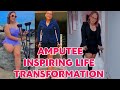 Amputee lady adaptive crutches user | embracing inspiring life transformation