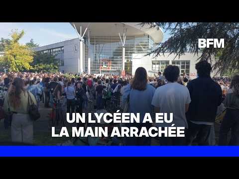 Lens: un lycéen a eu la main arrachée en ramassant une grenade policière