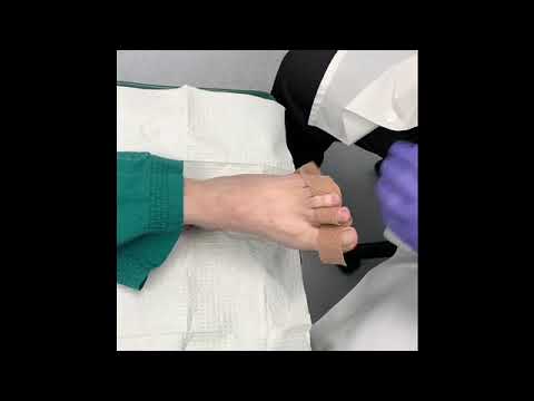 Hammertoe Bandaging