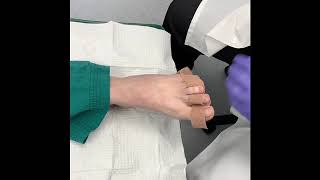 Hammertoe Bandaging