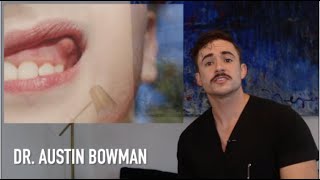 What If You Have A Dental Abscessswelling?