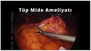Tüp Mide Ameliyatı