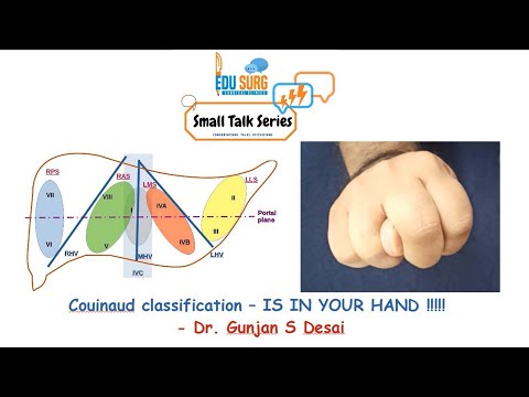 Anatomy of liver - Simplest trick for liver anatomy - Couinaud classification 