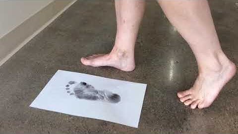 Infinity Orthotic Centre - Do you know your foot type
