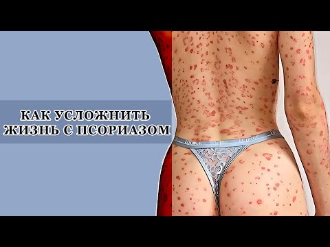 ЧТО МОЖЕТ УХУДШИТЬ ПСОРИАЗ #PSORIK