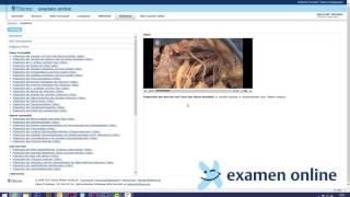 examen online: Präpkurs screenshot 5