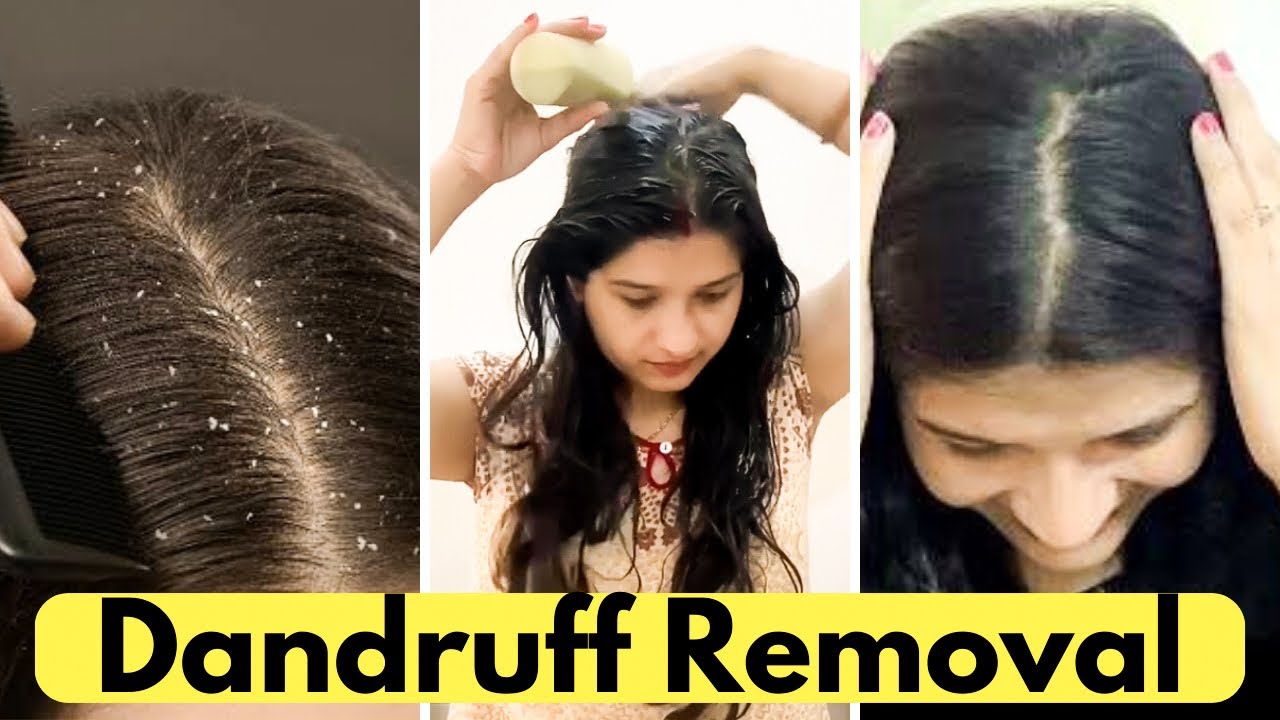 Dandruff Solution Neem Hair Mask & Oil Dandruff Removal Hair Care