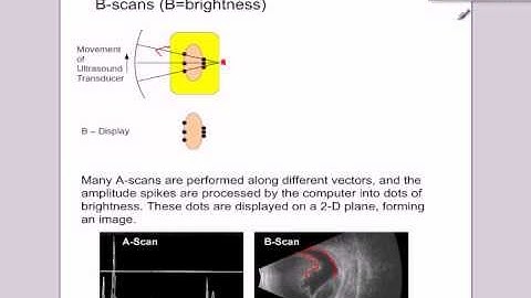 A level medical physics - ultrasound part 2  types of scan, A-scans, B-scans and M-scans