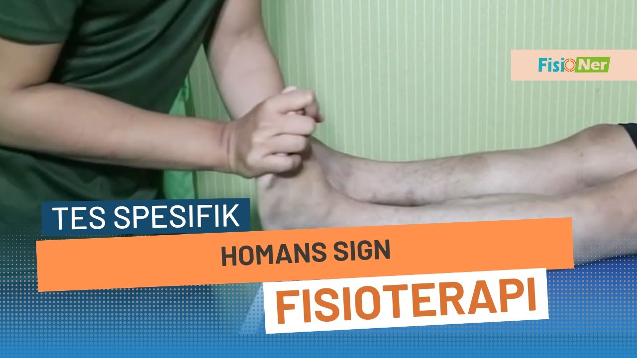 Homans Sign Youtube Homans Sign - Penyumbatas Pembuluh Darah di Kaki - YouTube